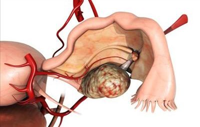  怎樣才能讓卵巢常“年輕”？