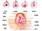 第五代韓式無痕處女膜修復術，10分鐘還你女兒身