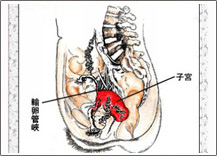 治療習(xí)慣性流產(chǎn)應(yīng)注意哪些
